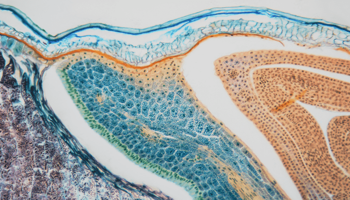 Lead image for article